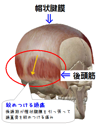 図解（後頭筋のトラブル）