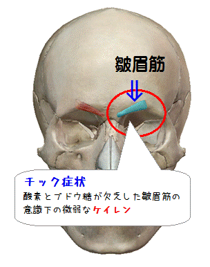 図解（チック症状）