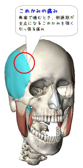 図解（こめかみの痛み）