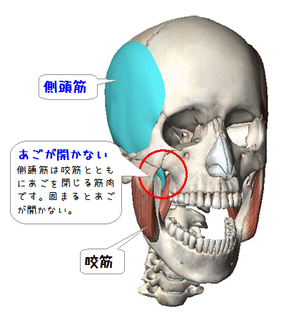 図解（あごが開かない）