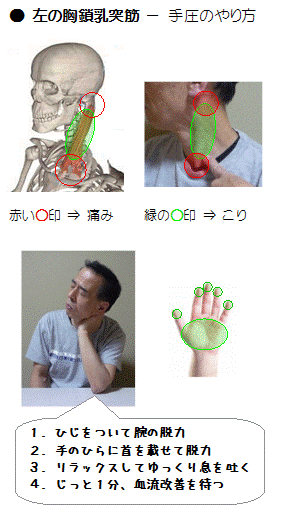 胸鎖乳突筋の手圧のやり方(図解)